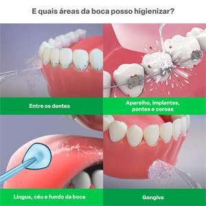 Bicos para Irrigador Oral Pack com 5 bicos Multi Saúde - HC066